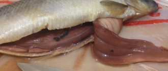 Анизакидоз