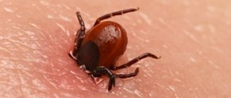 How to treat a tick bite - necessary actions when attacked by a parasite