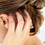 Черные точки на коже головы у ребенка