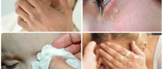 Достать мошку из глаза