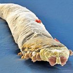 Фото 1. Глазной клещ Демодекс.