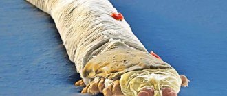 Фото 1. Глазной клещ Демодекс.