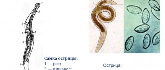 Глисты и острицы - фото, это одно и тоже, в чем разница, чем отличаются