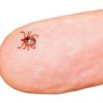 иммуноглобулин при укусе клеща