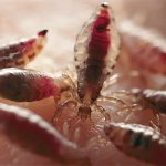 Избавление от вшей