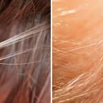 What lice look like in a child&#39;s hair (photo)