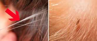What lice look like in a child's hair (photo)