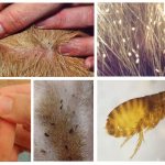 Как вывести блох из квартиры в домашних условиях