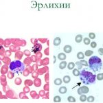 Клещевой моноцитарный эрлихиоз у человека. Анализ крови, симптомы и лечение