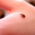 клоп на теле