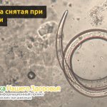 Круглые черви (нематоды): виды, строение и жизненный цикл