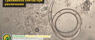 Roundworms (nematodes): types, structure and life cycle