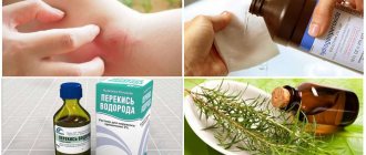 Лечение расчесанного укуса комара
