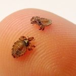 Лобковые вши на пальце