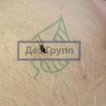 Midge on hand. What does a midge look like and its bite? 