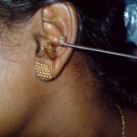 can a cockroach get into your ear or nose?