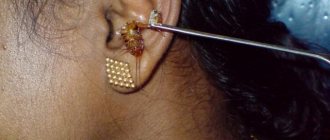 can a cockroach get into your ear or nose?
