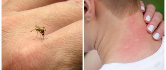 Опухоль и покраснение от укуса комара - что делать и чем лечить