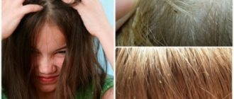 Откуда появляются вши у детей? Лечение педикулеза и профилактика
