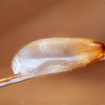 Let&#39;s try to figure out which methods of removing nits from hair are the most effective and at the same time safe to use.