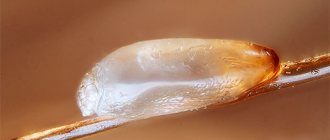 Let's try to figure out which methods of removing nits from hair are the most effective and at the same time safe to use.