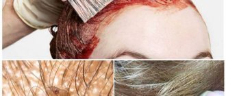 Does hair dye kill lice and nits?