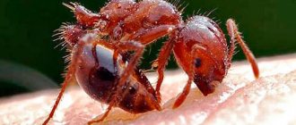 Ant bite on a person
