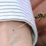 Bee sting