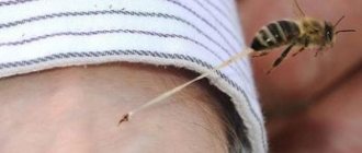 Bee sting
