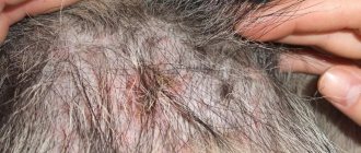 Bedbug bites on a dog