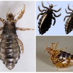 Types of lice