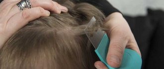 Timely detection of lice is a guarantee of quick relief from lice