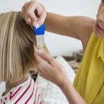 Вычесывание