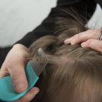 Вычесывание