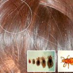 Яйца на голове ребенка